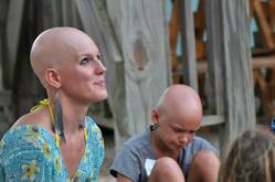 Hair Club Alopecia